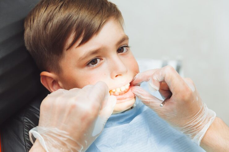 Pediatric Dental Crowns for Kids – Protecting Your Child’s Smile
