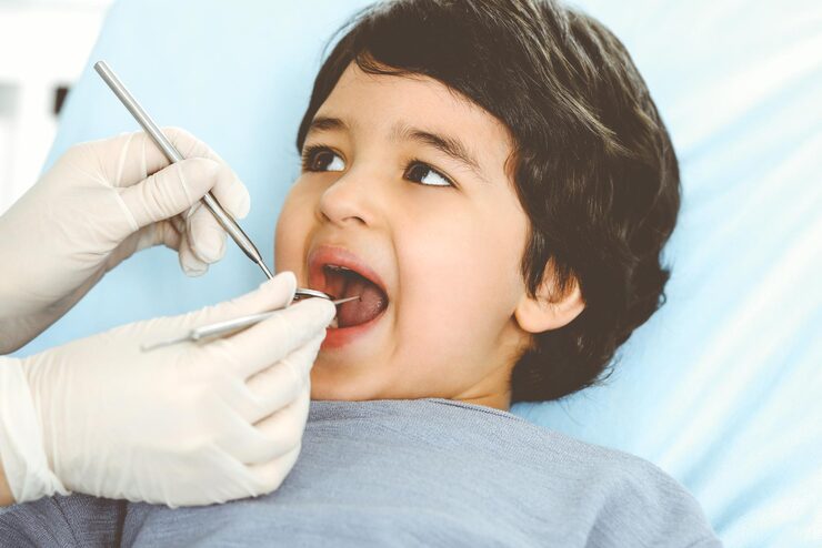 Pediatric Dental Fillings for Kids – Gentle Cavity Treatment for Healthy Smiles
