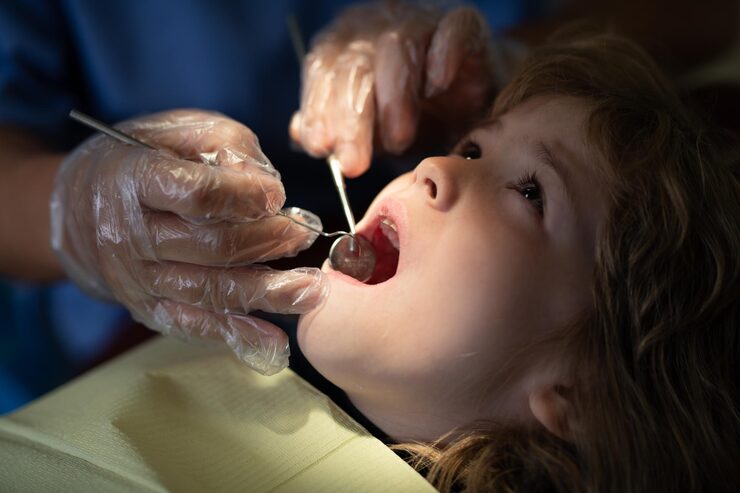 Pediatric Dental Fillings for Kids – Gentle Cavity Treatment for Healthy Smiles